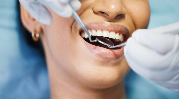 Best Emergency Wisdom Teeth Removal in New Hope, PA